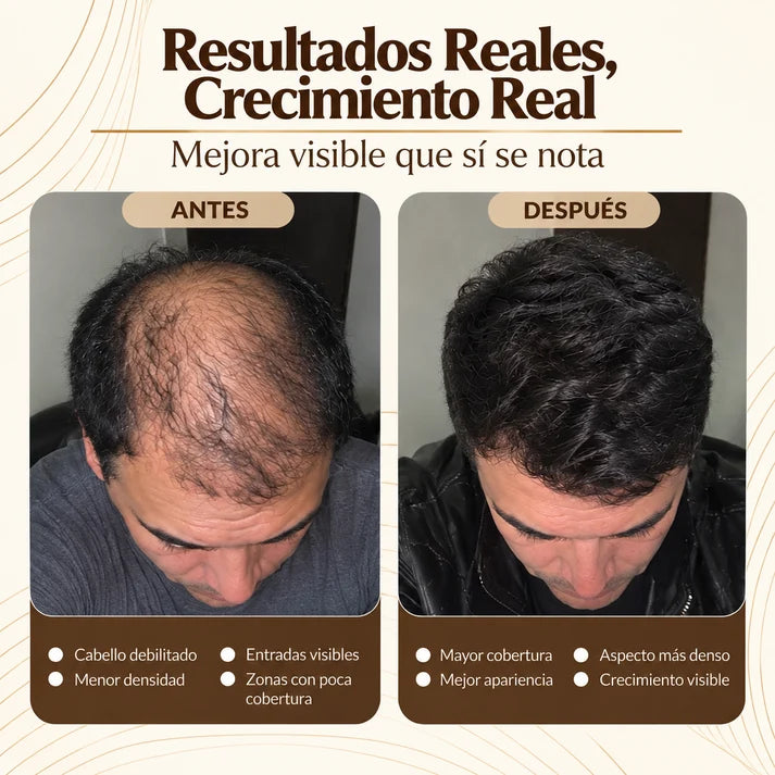 Shampo De Batana Crecimiento De Cabello Al Instante 💈